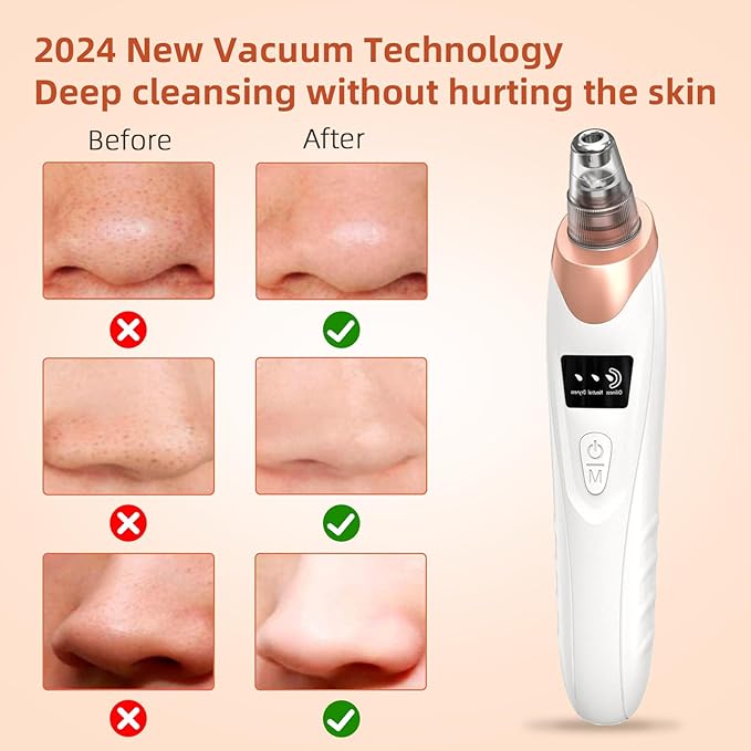 2025 Pore Vacuum, USB Rechargeable Blackhead Remover Vacuum,3 Levels Adjustable Pore Vacuum Blackhead Remover, with 5 Suction Power,6 Probes,Face Vacuum Pore Cleanser for Women & Men-White