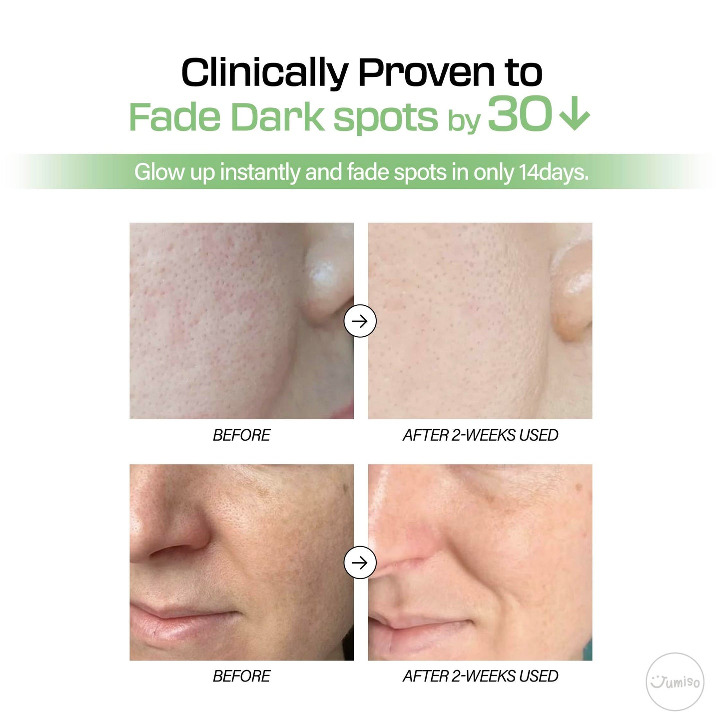 JUMISO All Day Vitamin Pure C 5.5 Glow Serum - L-Ascorbic Acid Alpha-Arbutin Aronia Extract Improves Pigmentation Hyperpigmentation - Korean Skincare, Dermatologist Tested Sensitive Skin 1.01 fl.oz.