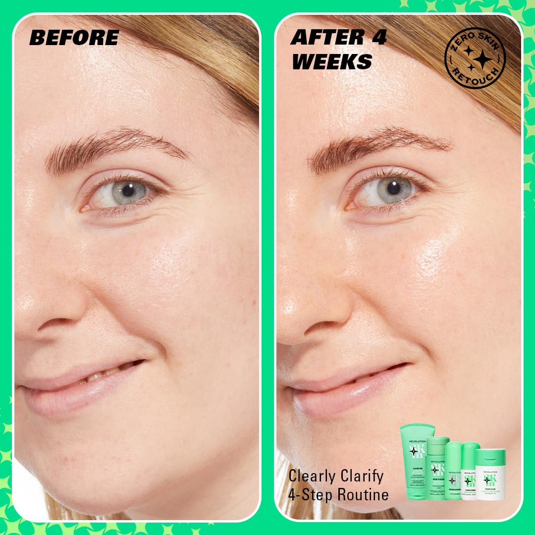 Revolution Skincare London, Clearly Clarify 4 Step Starter Kit, Skincare Set for Blemish-Prone Skin with Cleanser, Toner, Serum & Moisturizer, Vegan & Cruelty-Free, 4 Mini Products