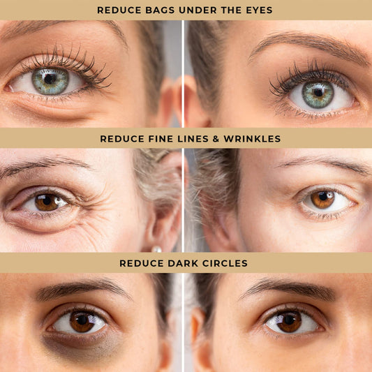 LPH LAB Temporary Eye Tightener Eye Cream, Instant Reduces Under-Eye Bags, Dark Circles&Puffiness, Anti Aging Fine Lines, Firm That Delicate Skin Under Your Eyes 0.5 oz