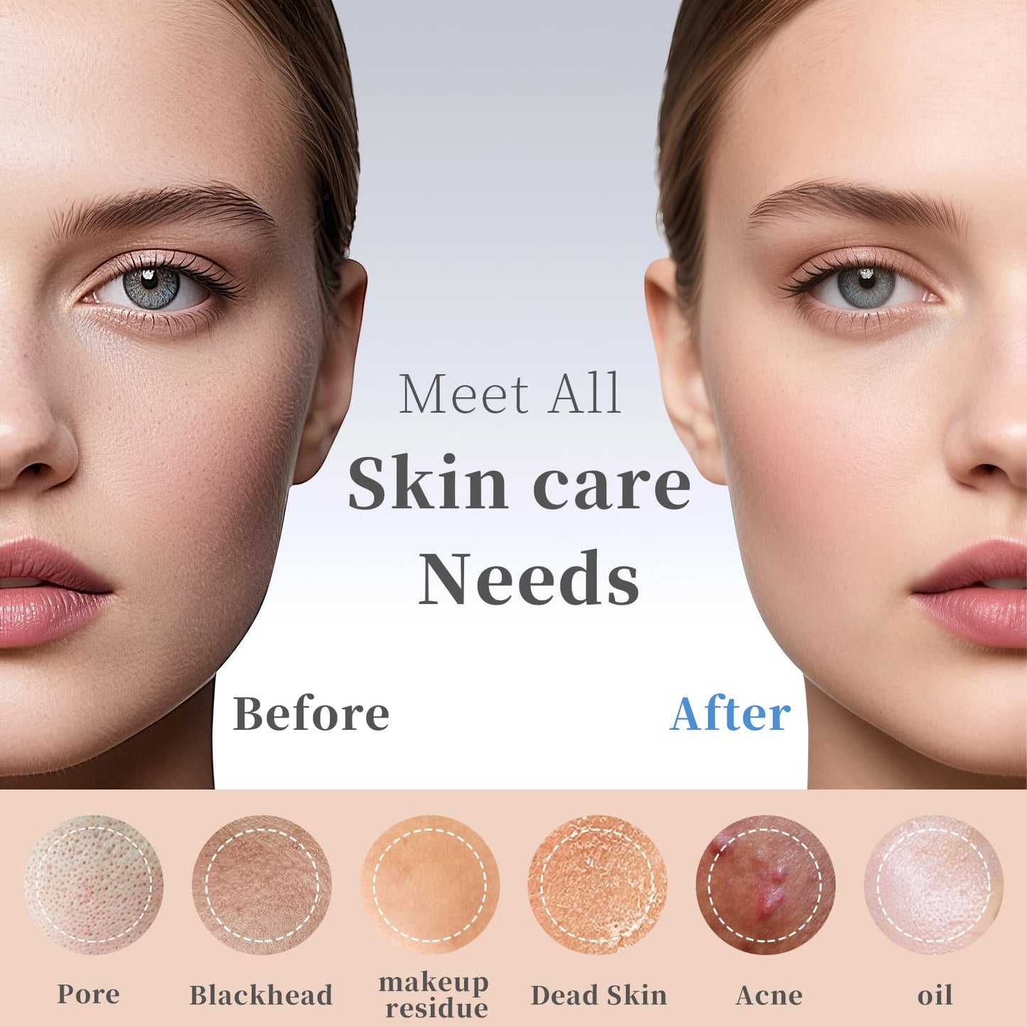 Blackhead Remover Tools, Black Head Remover for Face and Nose, Deep Pore Cleaner for Daily Skin Care, Skin Care Tools for Men and Women, Travel Blackhead and Whitehead Removal (Pink)