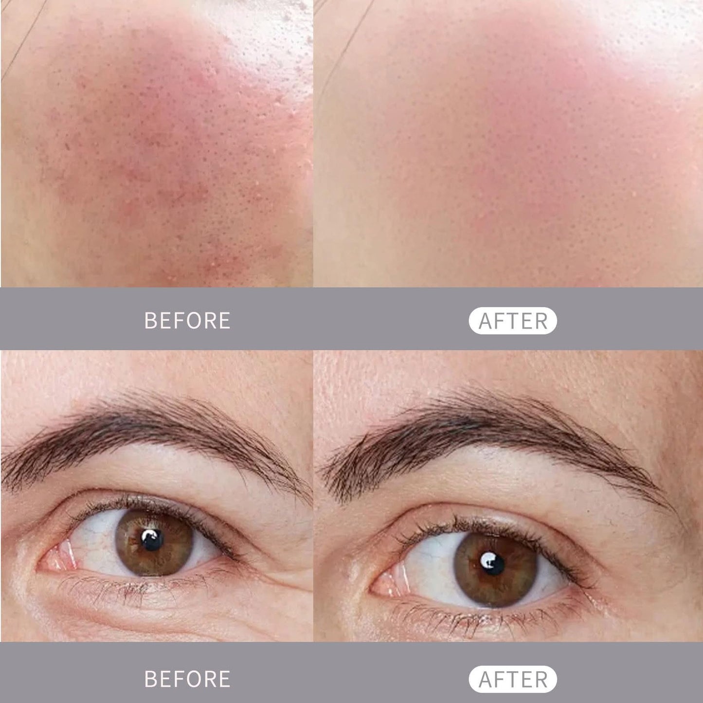 Rice Peeling Ampoule, Black and White Rice Serum Ampoule Duo for Face Exfoliant Dead Skin Remover, Day & Night Face Scrub, Gentle Peel + Pore Minimizing & Deep Hydration (Black Rice, 2.7floz)