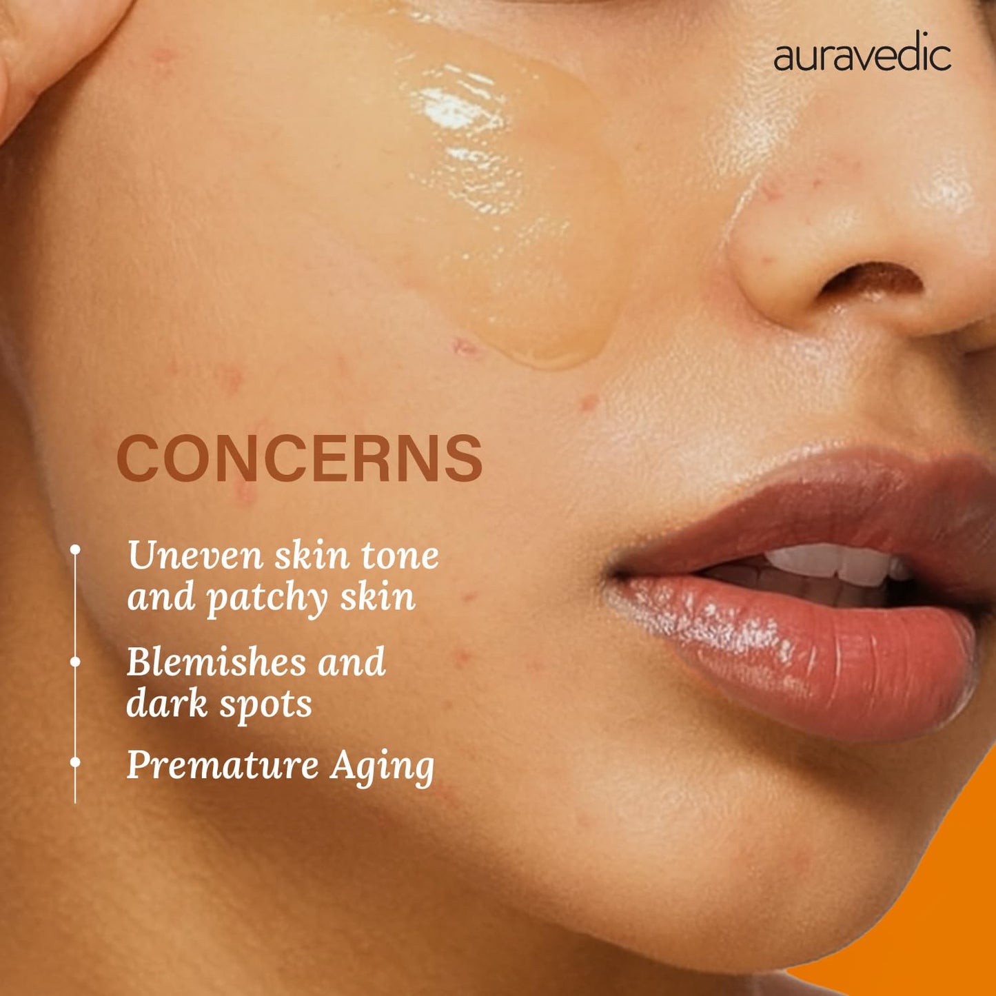 Auravedic Vitamin C Face Oil | with Rosehip, Avocado and Vitamin E | Natural & Organic Skin Moisturizer | Ayurvedic Facial Massage Oil for Soft, Smooth Skin | 3.38 Fl Oz (100ml)