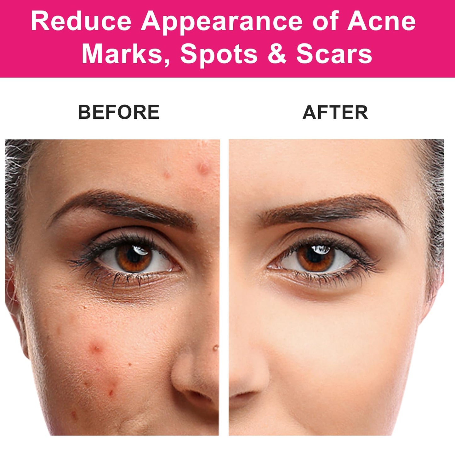 MMPANG Organic Rosehip Seed Oil for Face, USDA Certified, Cold Pressed, Unrefined, 100% Pure Natural Rose Hip Oil (1oz / 30ml) for Anti-Aging, Acne Scar Treatment, Skin & Hair Care, Gua Sha Massage