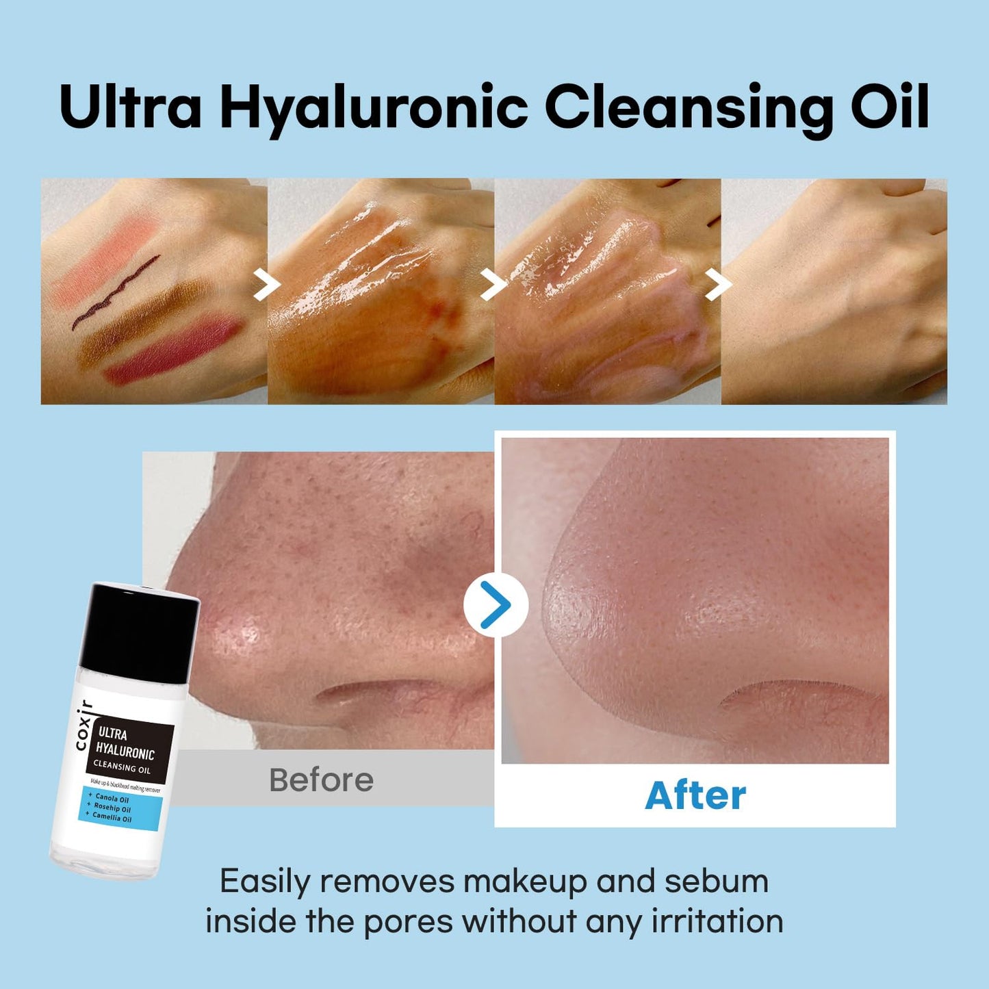 [Travel KIT] coxir Ultra HYALURONIC/Cleansing Oil+Toner+ampoule+Cream Holiday Miniature/[2.68 fl.oz (Pack of 1)] / Korean Skin Care