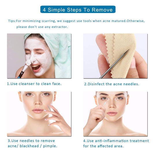 5PCS Blackhead Remover Comedone Extractor, Curved Blackhead Tweezers Kit, Professional Stainless Pimple Acne Blemish Removal Tools Kit for Manual