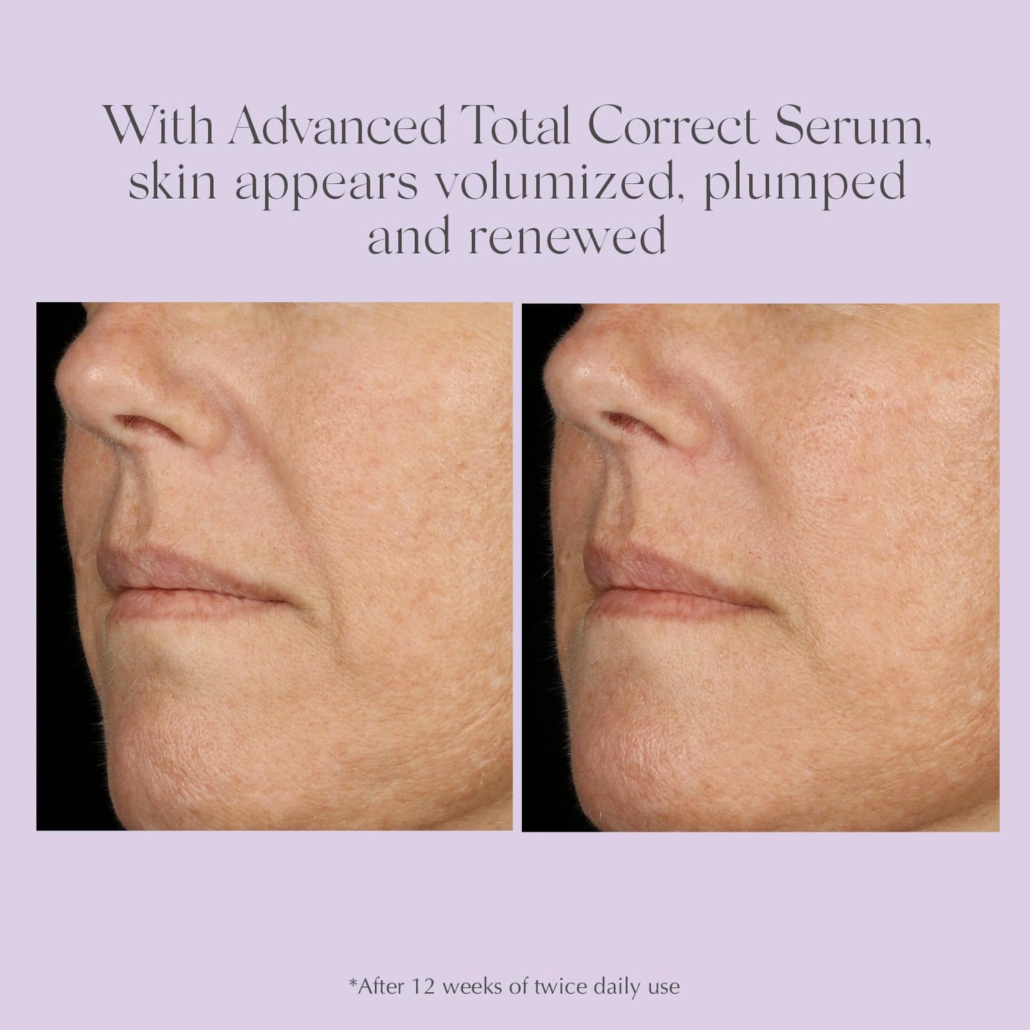 EXUVIANCE AGE REVERSE+ Anti Aging Skin Care Set - Mini Starter Kit Includes: Exfoliating Face Wash, Anti-Wrinkle Serum, Brightening Eye Contour, Firming Face Cream, for Wrinkles and Fine Lines - 4 ct