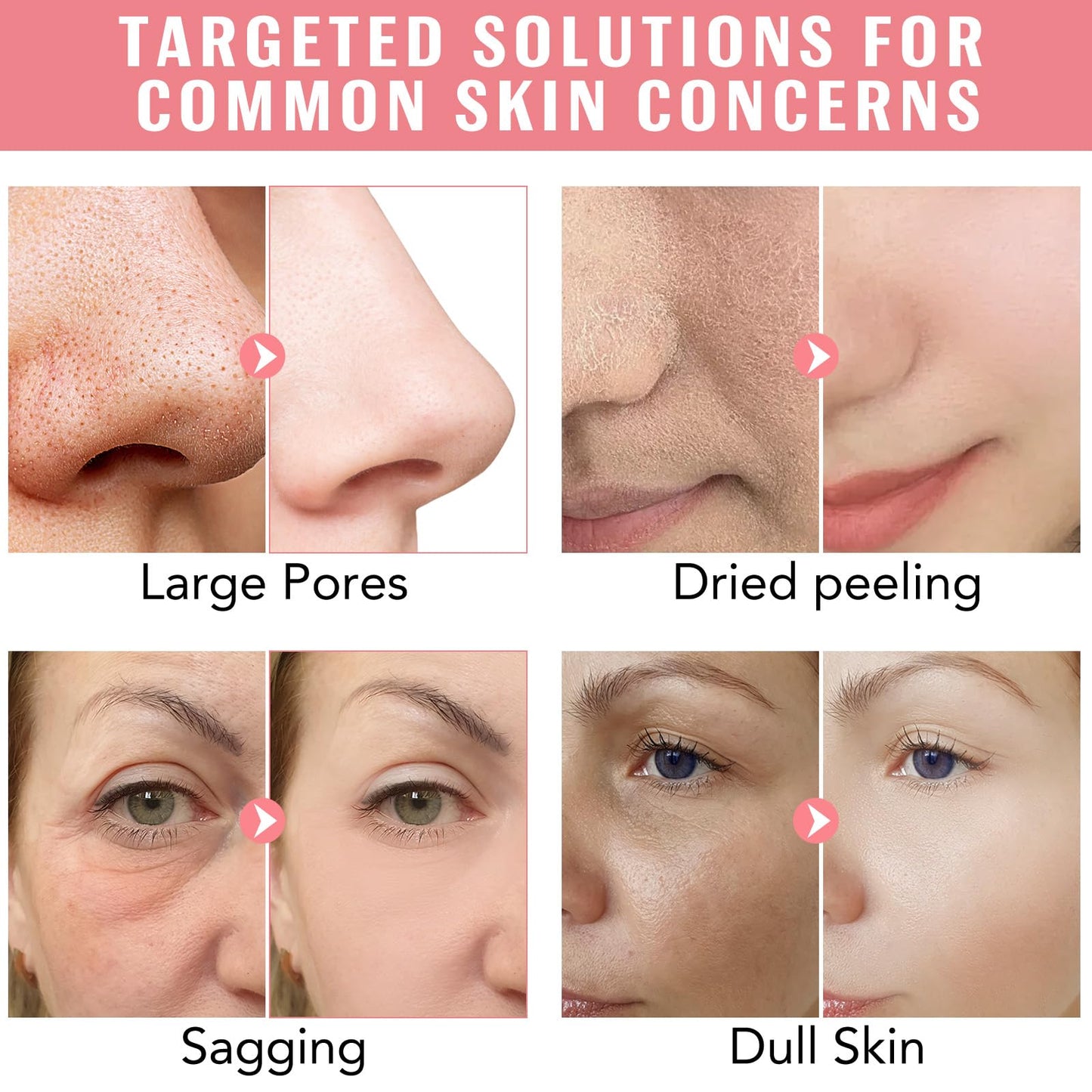 Ninsiec Collagen Face Masks – Deep Hydrating & Firming Overnight Hydrogel Mask, Anti-Wrinkle Lifting, Real Collagen Infused for Plump Skin (4 pcs)