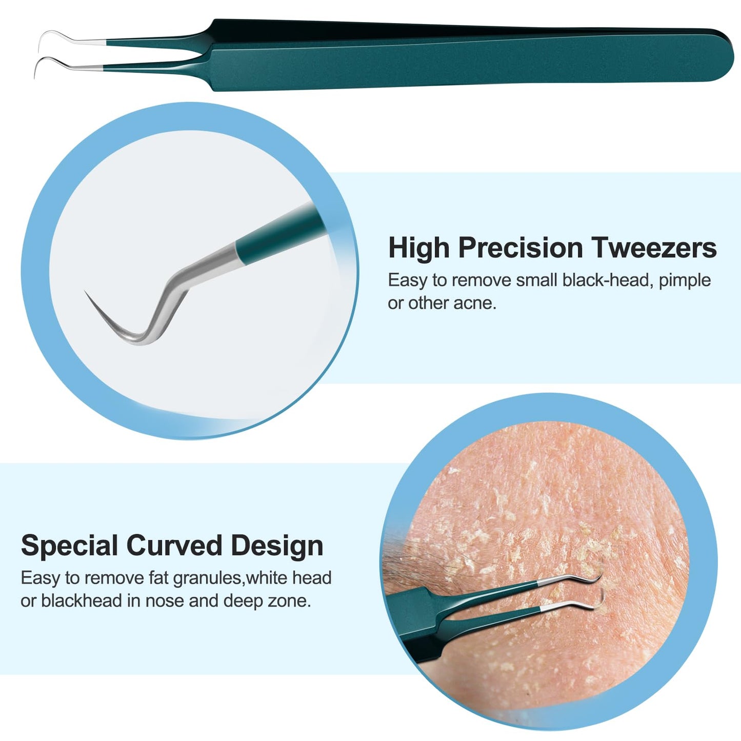 Blackhead Remover Tools Pimple Popper Tool Kit Comedones Extractor Acne Removal Kit for Whitehead, Blemish, Popping. 5pcs Pimple Extractor with Blackhead Tweezers for Nose Face