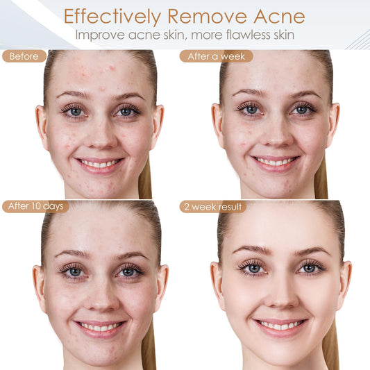 18FTRabbit Blue Red Light Theràpy Màsk for Face, 7 Colors led face màsk Light Theràpy, Skin Care Màsk for Face for Mom Mather or Wife