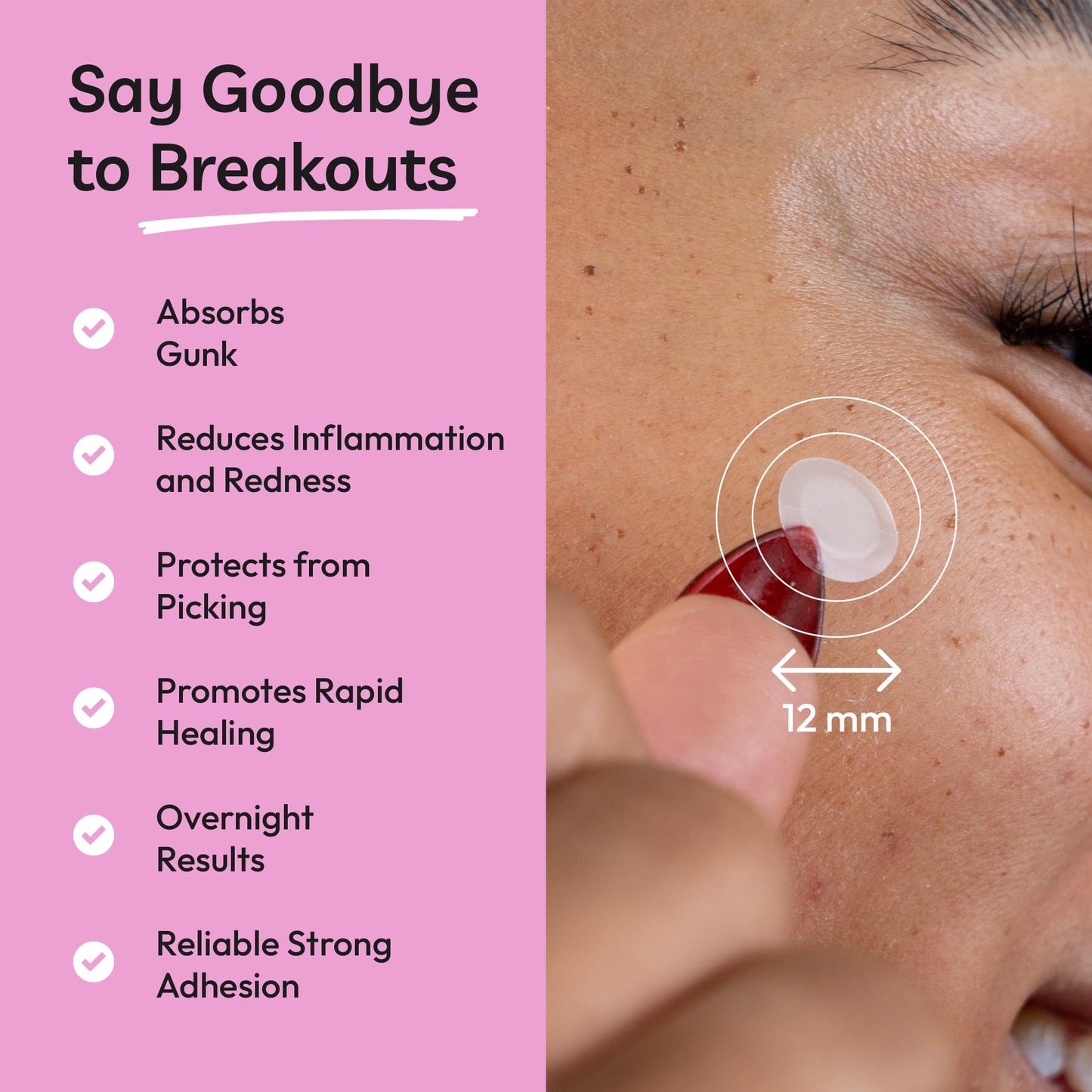 Clear Molecules Spot Stoppers Pimple Patches - Invisible Spot Patches for Acne Treatment, Hydrocolloid Patches for Spot Treatment, Vegan & Cruelty Free Korean Skincare (30 Count (Pack of 1))