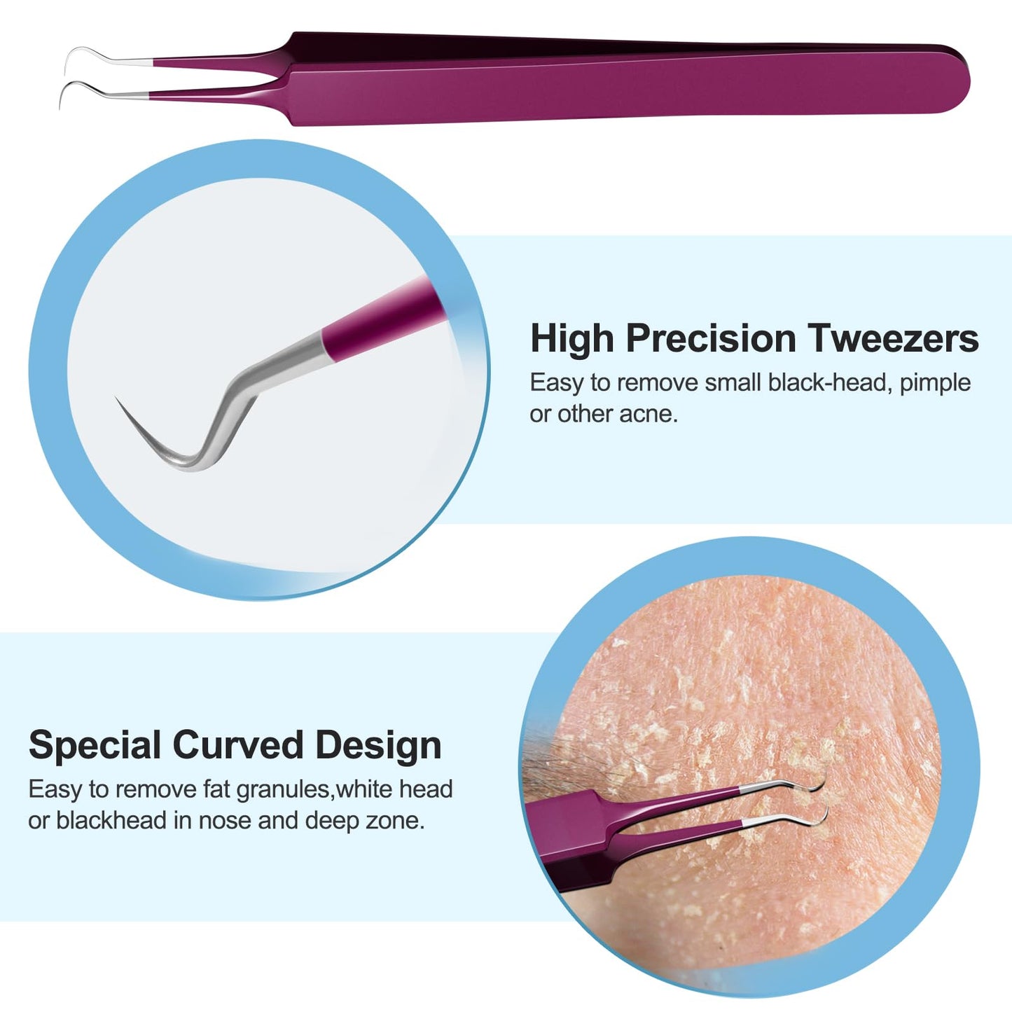 Blackhead Remover Tools, Face Scraper for Deep Cleaning, Pimple Popper Tool kit, Skin Scrubber Face Spatula, Skin Care Tool for Men and Women (Rose red)