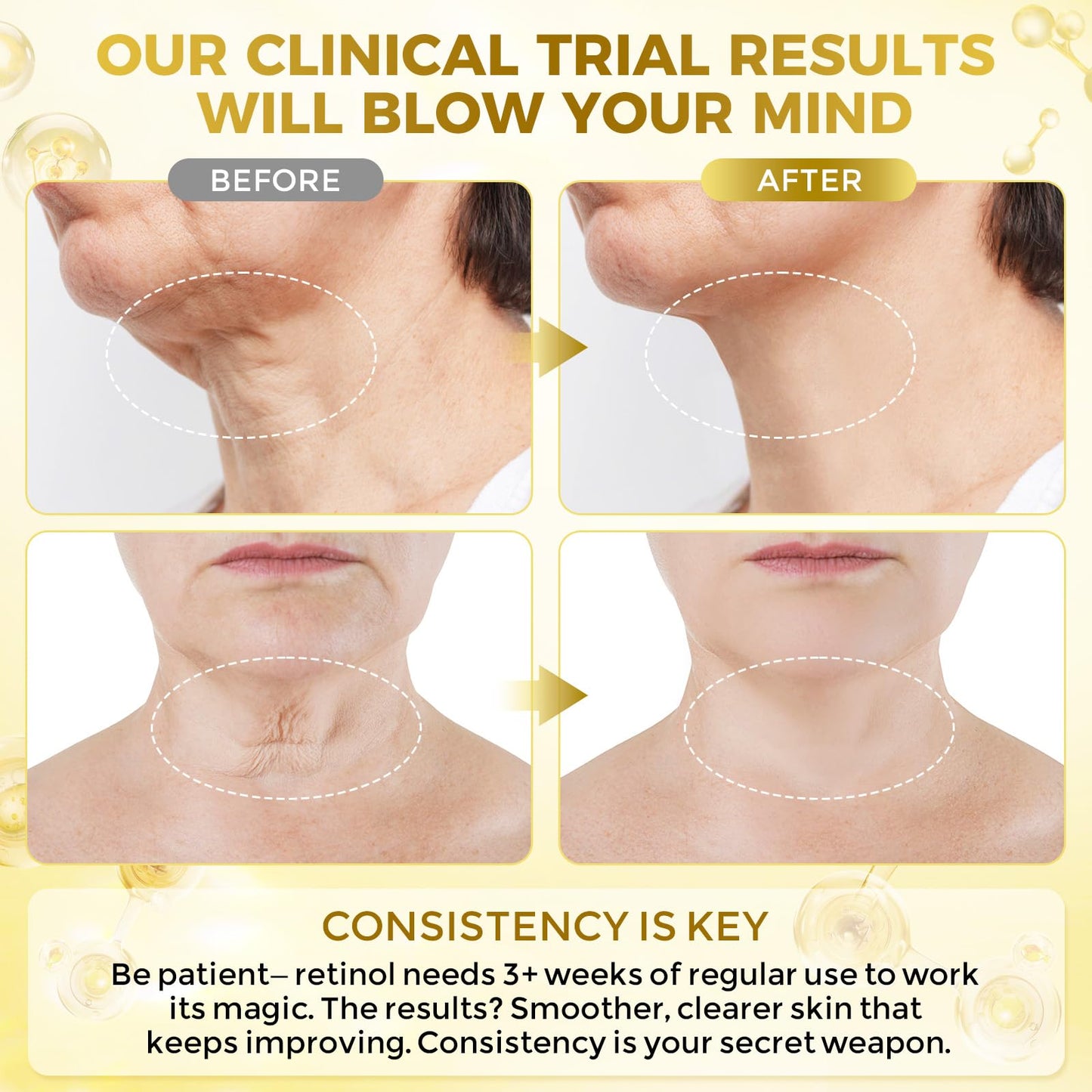 Neck Firming Cream, Anti Aging Wrinkle Cream with AH-8, Retinol, Collagen, & Hyaluronic Acid, Neck Creams for Tightening and Firming for Women & Men, Deep Hydration, Day & Night, 1.7 Fl Oz