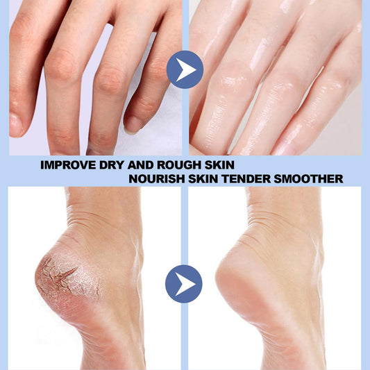 RTQSU Crack Feet Prevention Stick, Anti Crack Foot Cream Stick, Foot Care Cream Cracked Feet, Moisturizing Foot Balm, Softening and Nourishing Cream for For Dry Heels