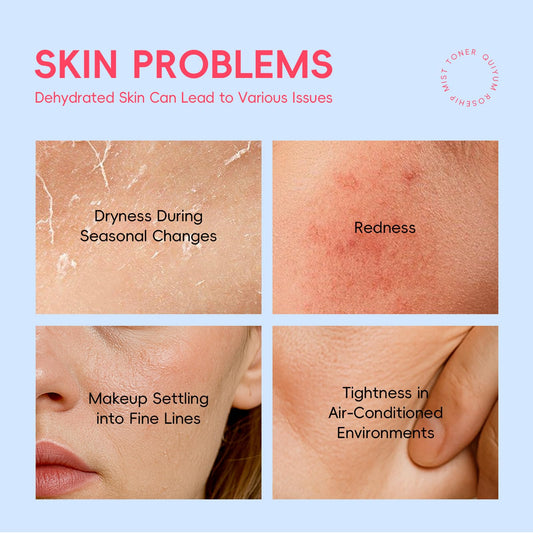 Quiyum Rosehip Skin Care Set, Beauty Skincare Gift Sets, Natural Facial Skin Care Products, Korean Style Skincare for Women, Nourishing, Hydration, Glow Up, 3PCS