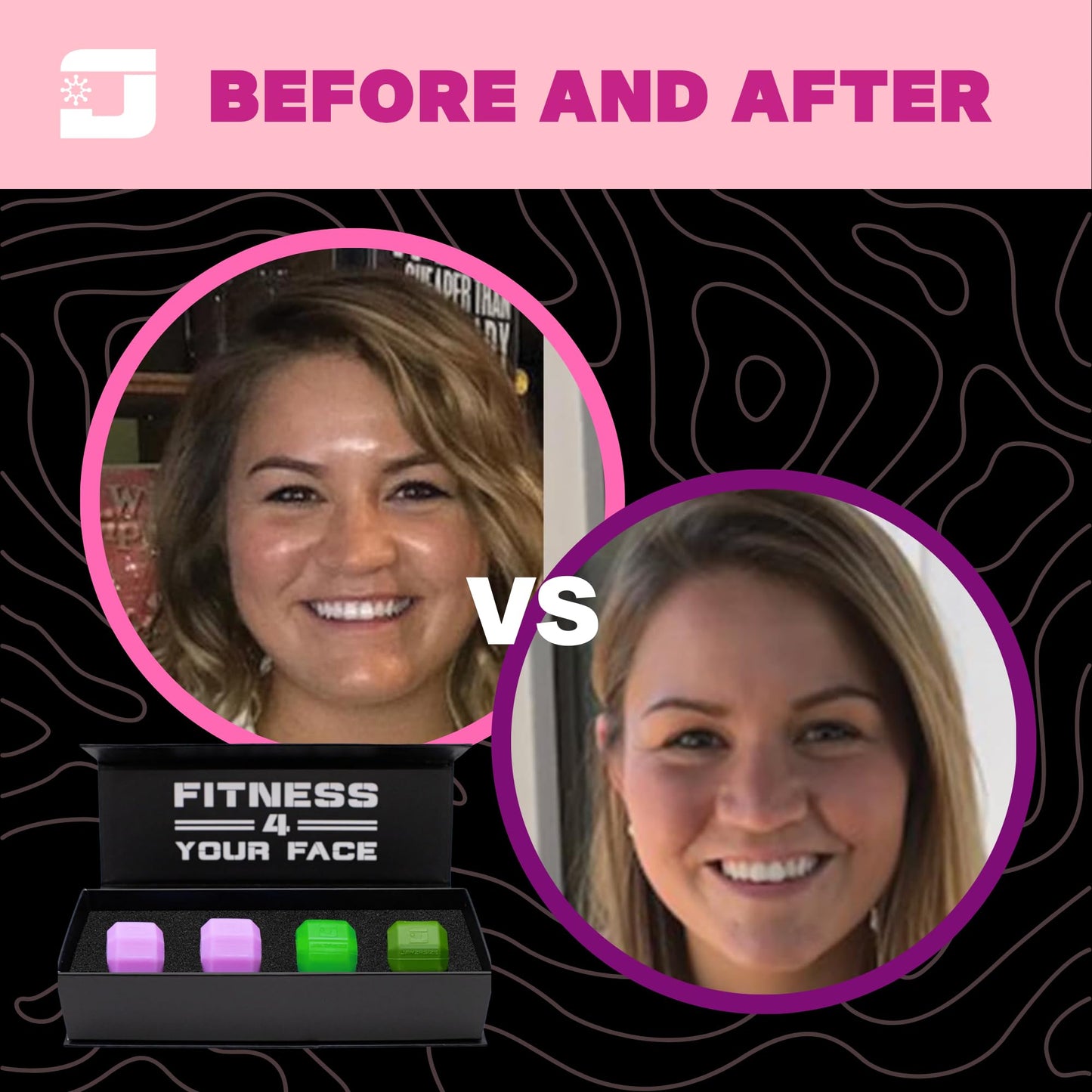 Jawzrsize Jaw Exerciser for Women - Double Chin Reducer, Facial Toner, Neck Exerciser for Younger and Healthier Look Helps Reduce Stress and Cravings Jawline Trainer (Ladies Kit)