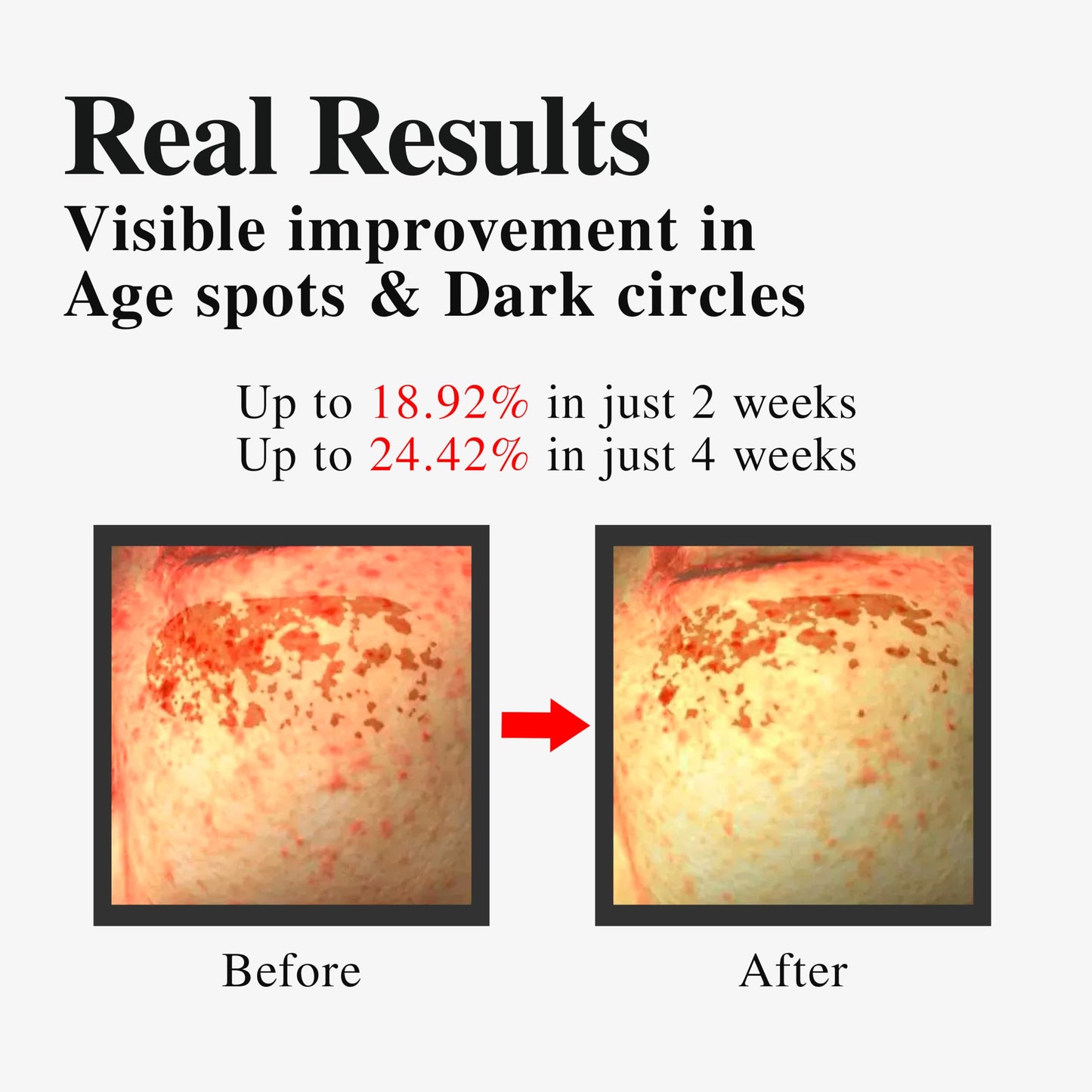 BARULAB Galvanic Dark Spot Serum Auto Depuffing Lifting Eye Cream - Deeply Penetrates Corrects Uneven Skin Tone Hyperpigmentation Dark Circles Fine Lines Wrinkles Puffiness Korean Skincare