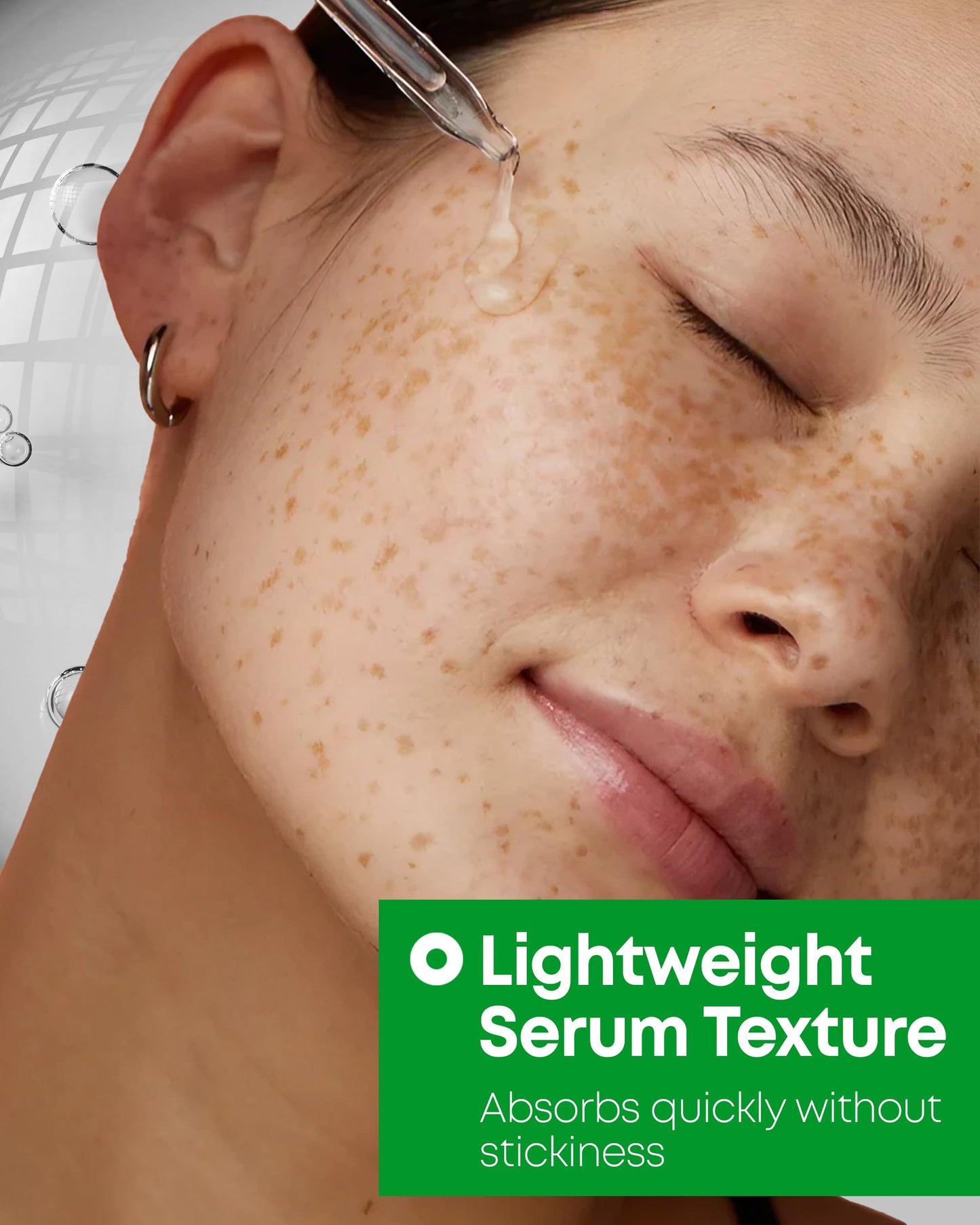 A-Control 10% Azelaic Acid Serum - Korean Acne Serum for Face - Calming Facial Treatment Clearing Breakout, Pimples - for Acne-Prone & Dull Skin, 1.01 fl.oz.