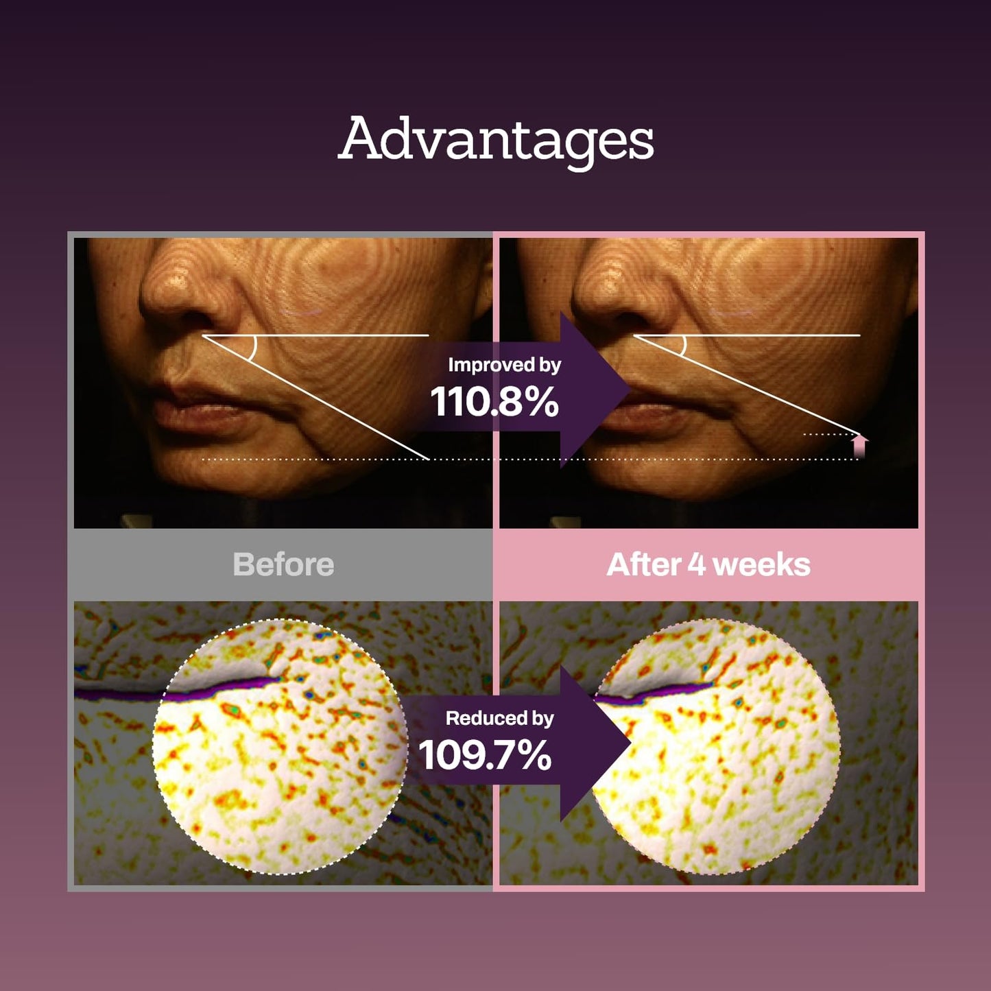 Collagen Peptide 12X Boosting Serum, Enhances Skin Elasticity & Reduces Deep Wrinkles, Promotes Collagen Production for Firm and Youthful Skin, Korean Skincare, 1.01 fl.oz