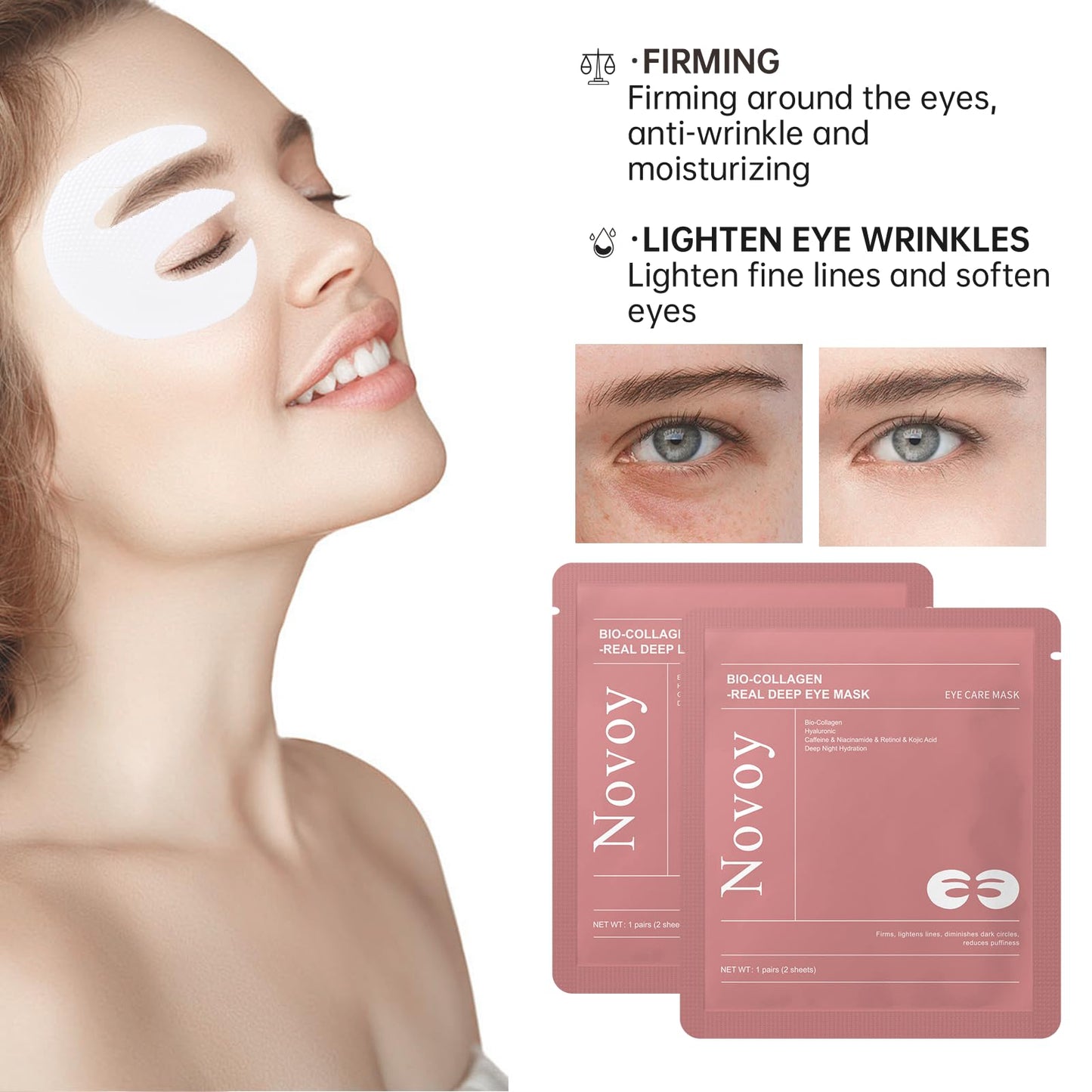 Novoy 15 Pairs Bio-Collagen Real Deep Eye Patches - 6-in-1 Retinol Overnight Eye Patches for Dark Circles, Puffiness & Wrinkles | 2% Caffeine+Hyaluronic+Niacinamide, Korean Popular Eye Mask - ROSE