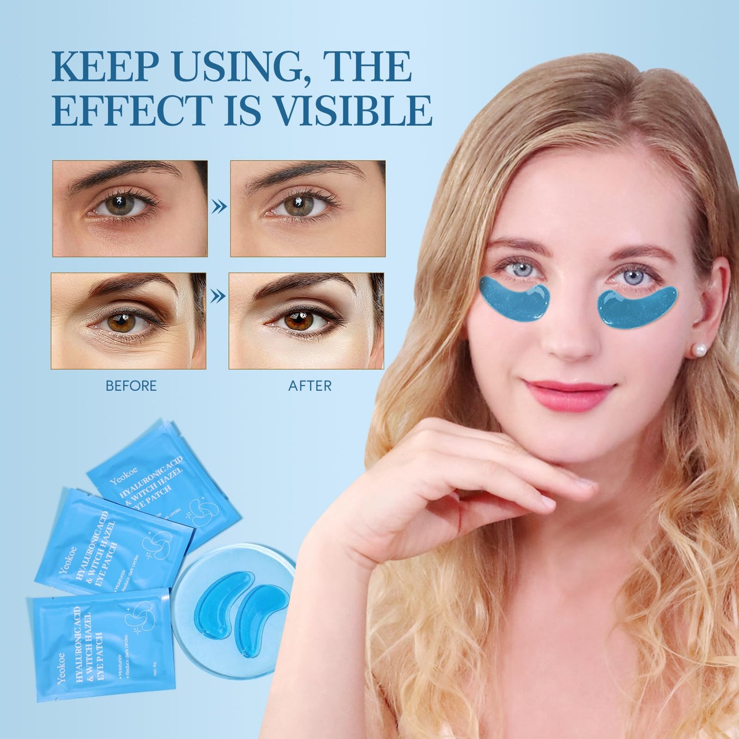 Yeokoe Under Eye Patches for Dark Circles,Puffy Eyes,20 Pairs Face Masks SkinCare With Hyaluronic Acid Witch Hazel for Moisturize