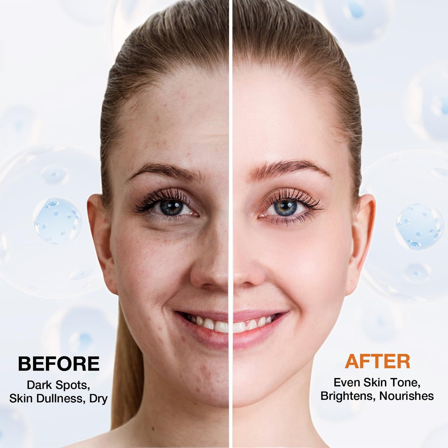 Asumtal Dark Spot Remover For Face Skin Care Serum, Age Brown Sun Freckles Spot Remover, Dark Spot Corrector For Face with Massage Roller (0.67 Fl Oz)