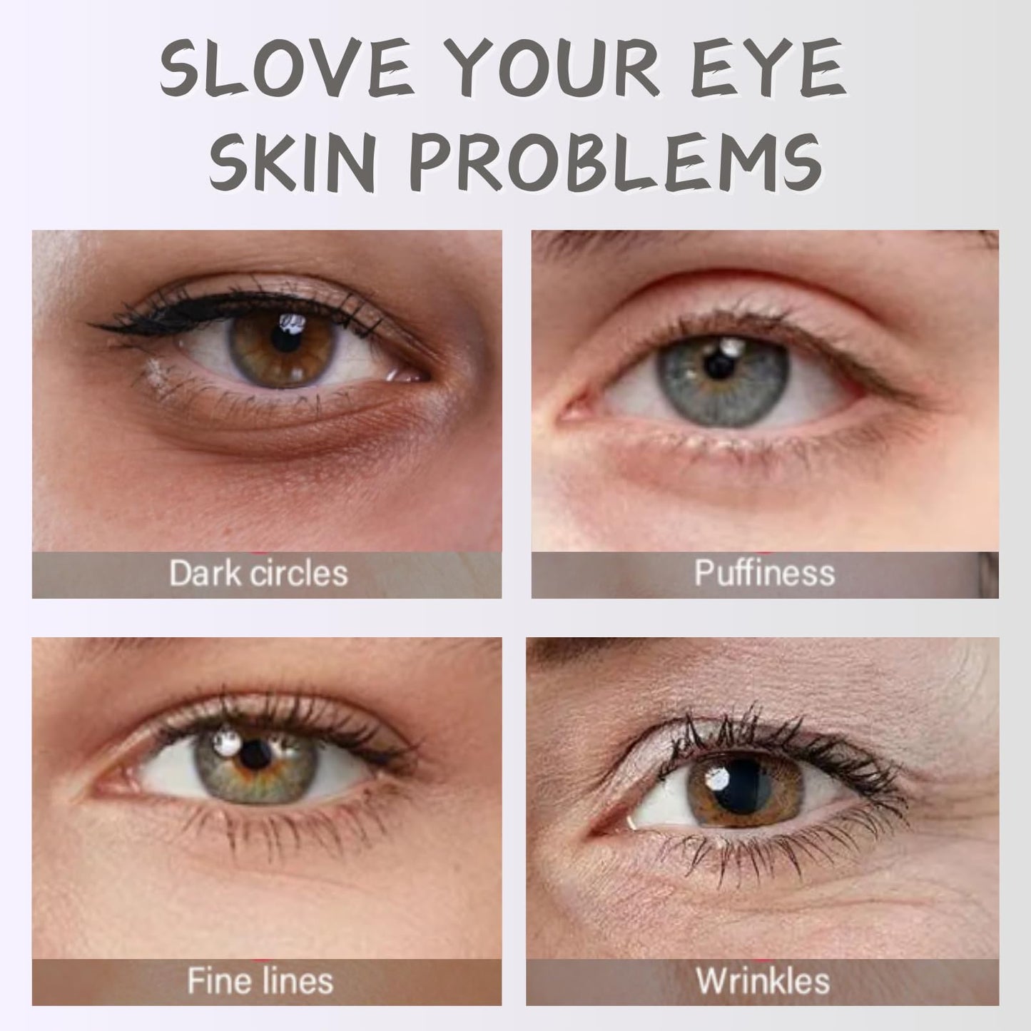 Evolvique Rosehip Under Eye Cream for Dark Circles - Eye Cream Anti Aging - Anti Wrinkle eye cream for Puffiness and Bags Under Eyes - Firming Eye Serum for Women - Best Under Eye Treatment for Bags