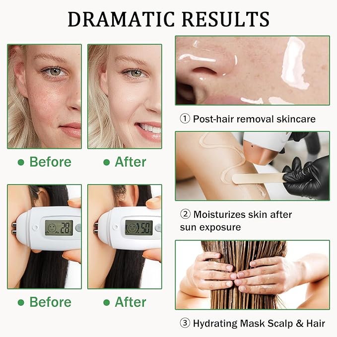 Aloe Vera Gel for Sunburn Relief,Hydrating Travel Size Aloe Vera Gel for Face,Moisturizing Sunburn Relief After Sun Lotion,Fast Absorbing,Non-Sticky Cooling After Sun Lotion Face Moisturizer (C)