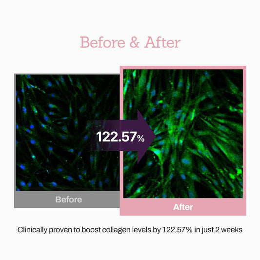 Collagen Peptide 12X Boosting Serum, Enhances Skin Elasticity & Reduces Deep Wrinkles, Promotes Collagen Production for Firm and Youthful Skin, Korean Skincare, 1.01 fl.oz