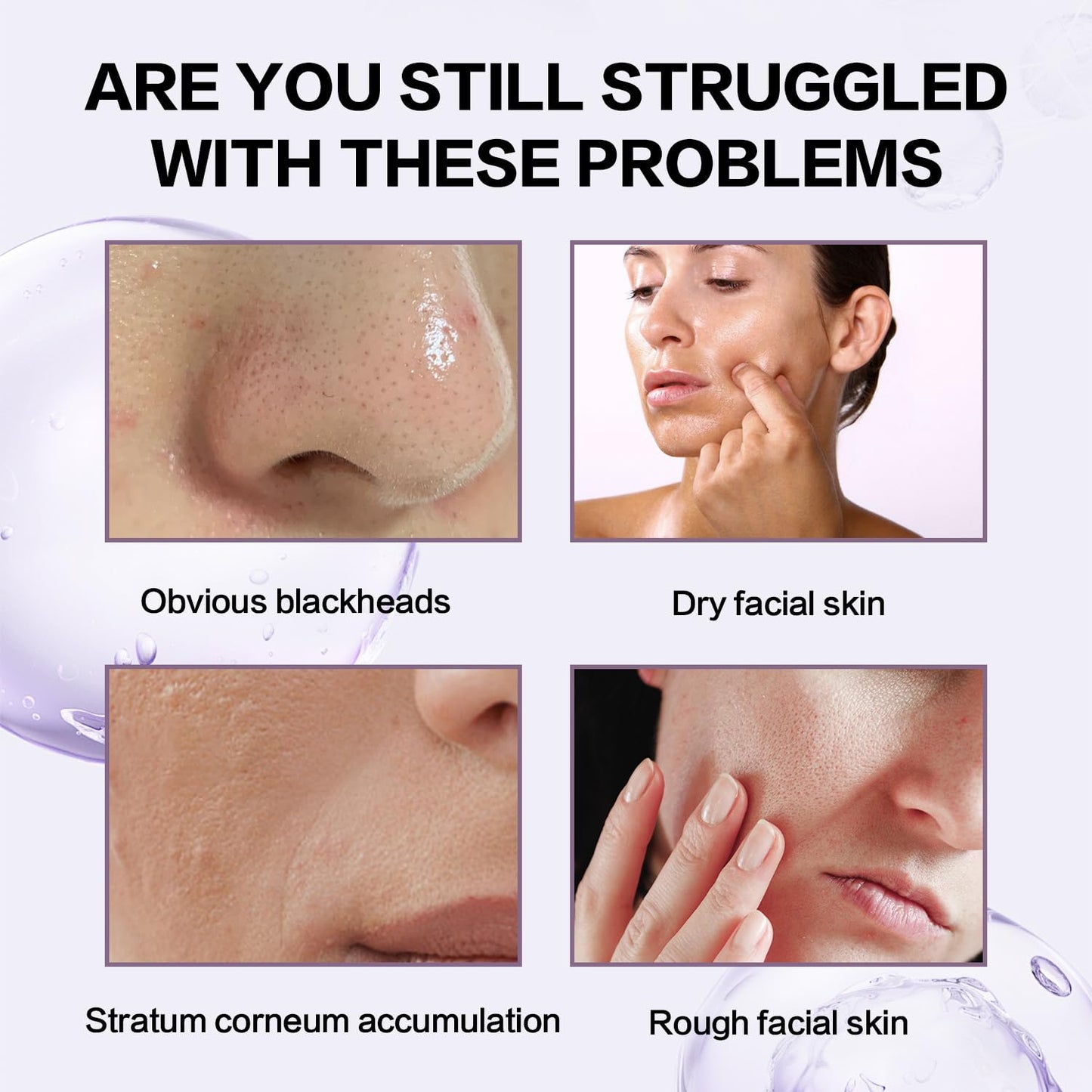 Rice Peeling Ampoule, Soft Exfoliating, Dead Skin and Blackheads Remover, Moisturizing, Travel-Friendly For All Skin Types