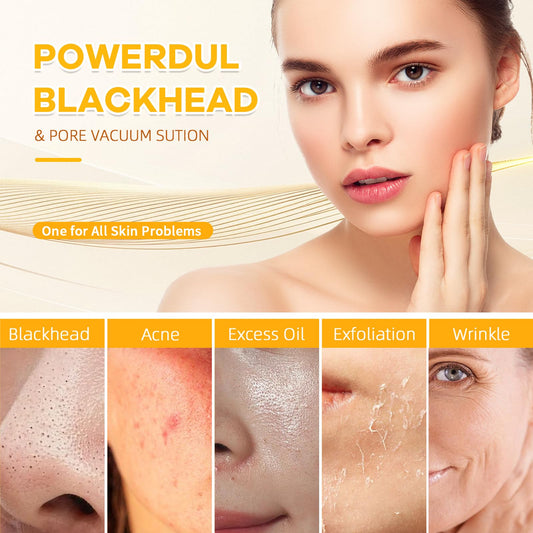 2025 Pore Vacuum with Camerafor, USB Rechargeable Blackhead Remover Vacuum,3 Levels Adjustable Pore Vacuum Blackhead Remover, 6 Suction Heads,Face Vacuum Pore Cleanser for Women & Men