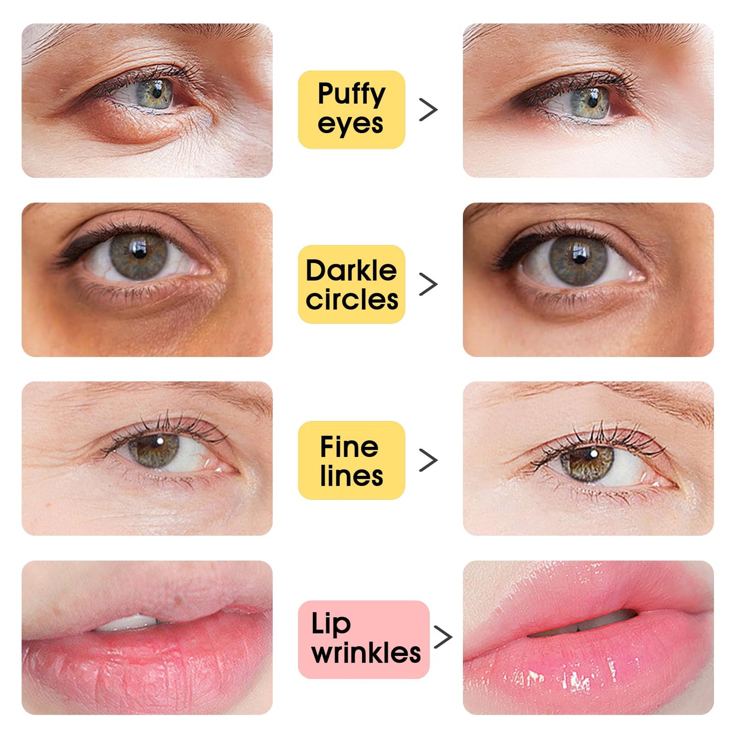 40 PCS Under Eye Patches and Gold Lip Mask 24K Gold Eye Mask for Puffy Eyes Collagen Lip Masks and Crystal Eye Mask Reducing Fine Lines for Women and Men