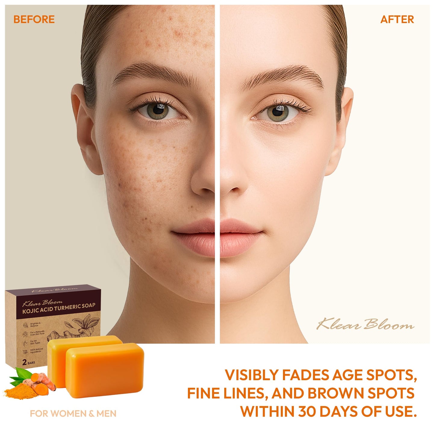 KlearBloom Kojic Acid Soap, Turmeric Soap Bar for Dark Spots Brightening & Moisturizing with Collagen, Vitamin E, Retinol, Hyaluronic Acid, Shea Butter, Paraben & Sulfate-Free 105g x 2 Bars