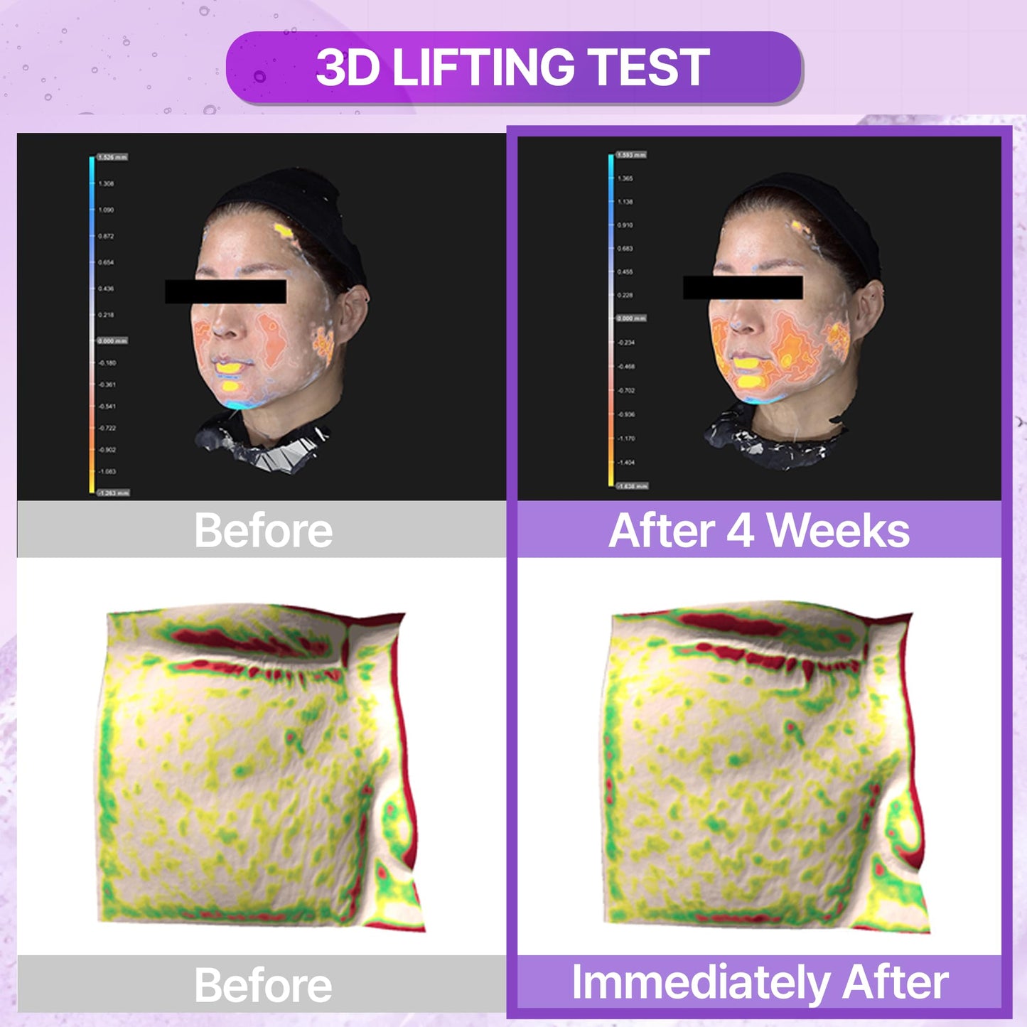 BIOHEAL BOH Probioderm 3D Lifting Essential Toner 5.07 fl oz (150 ml) | Hydrating & Lifting Face Toner with 17-Peptide Complex for Firmness & Elasticity