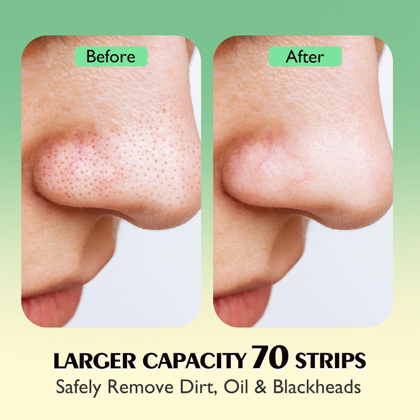 AUSLKA Blackhead Pore Strips,(70 Counts) Blackhead Remover-Deep Cleansing Nose Strips With Instant Pore Unclogging, Nose Plant Strips for Blackheads