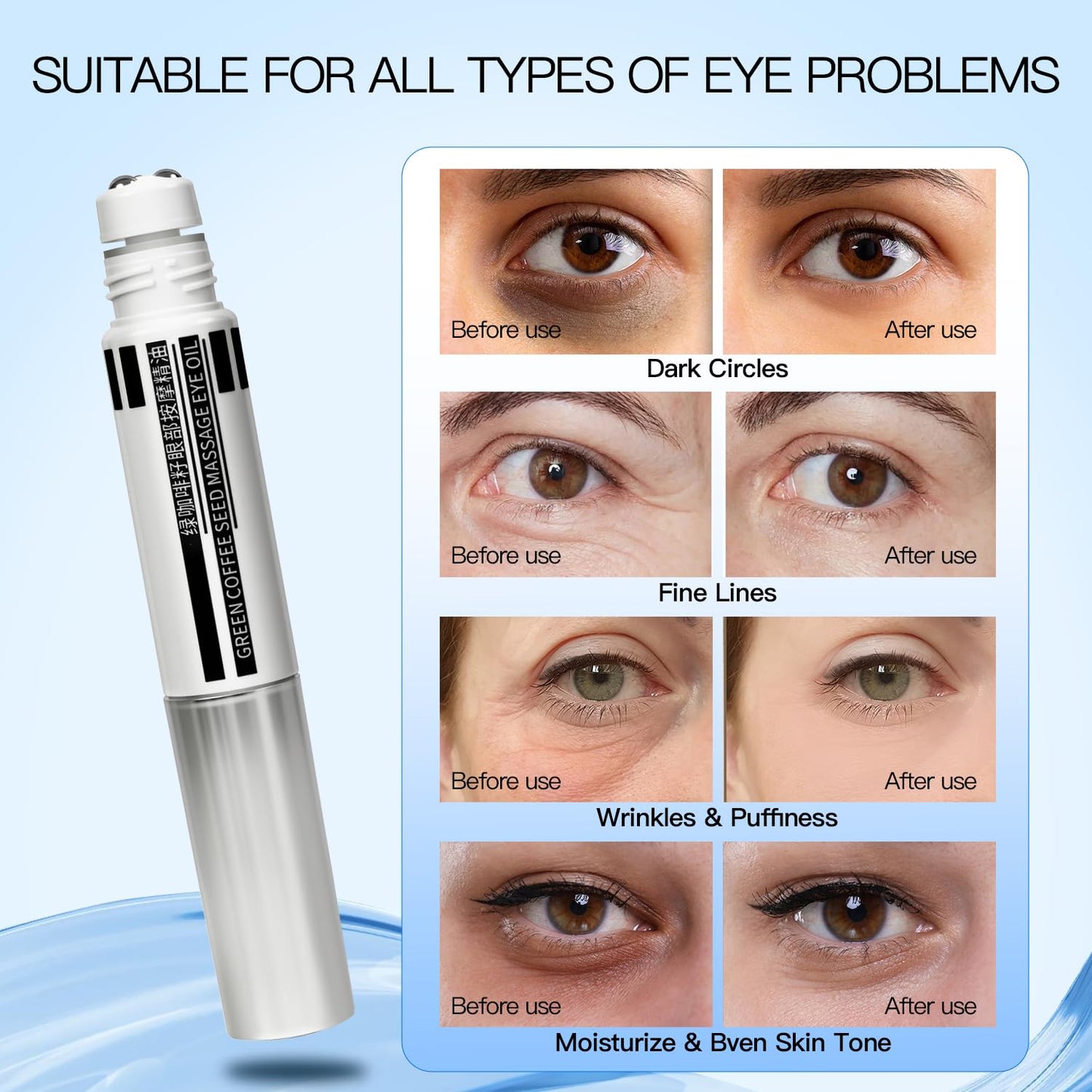 WARMTREE- Eye Cream For Dark Circles, Electric Massage Eye Cream, Suitable, Effectively Remove Fine Lines, Dark Circles, Puffiness & Even Skin Tone, For All Skin Types