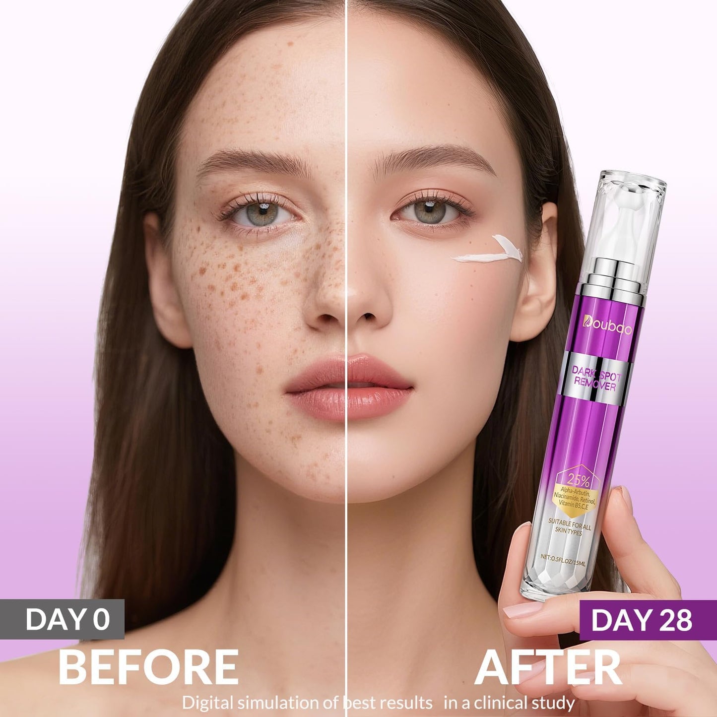 Dark Spot Remover for Face and Body, Age Spot Sun Spot Freckles Remedy Corrector Serum,Melasma Treatment for Face, Advanced Fade Cream for Uneven Skin Tone with 360° Roller Massage Ball, 0.5 FL oz