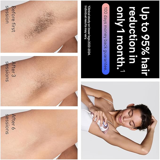 Braun Smart IPL, Skin i·Expert Pro 7: at Home Laser Hair Removal, Permanent Visible Hair Reduction, Holiday Gifts for Women and Men with Free App, Vanity Case, Venus Razor, 3 Smart Heads, IPL7243