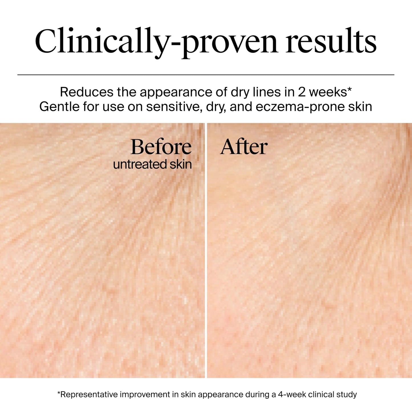 Neutrogena Hydro Boost Gel Cream, 48 Hr Hydration for Normal/Dry Skin, Fragrance Free, Face Moisturizer with Hyaluronic Acid, 1.7 oz. & Trial Size Hydro Boost Hydrating Gel Cleanser, 0.5 fl oz