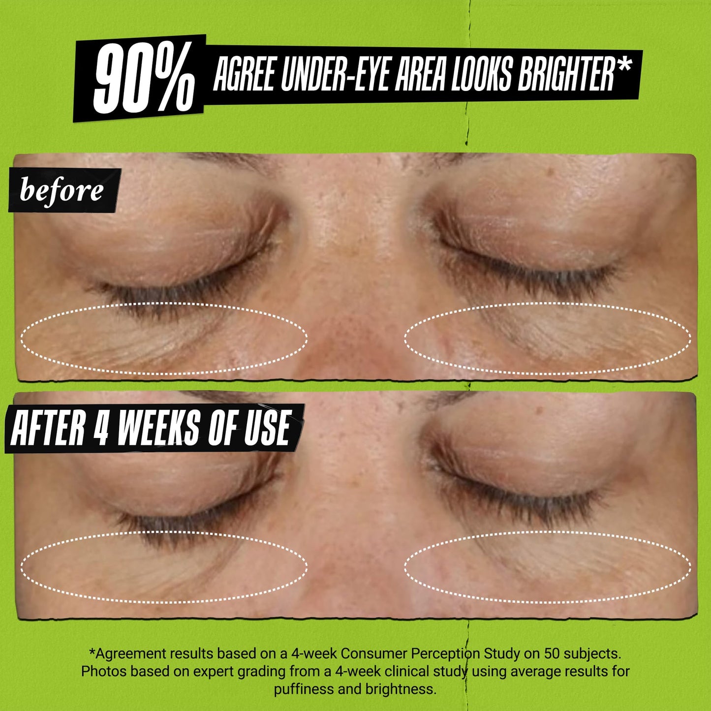 Kiehl's Avocado Eye Treatment, Nourishing and Hydrating Eye Cream, Avocado Oil and Caffeine to Energize and Invigorate Skin, Tired Eyes, 99% Naturally Derived Formula - 0.5 fl oz