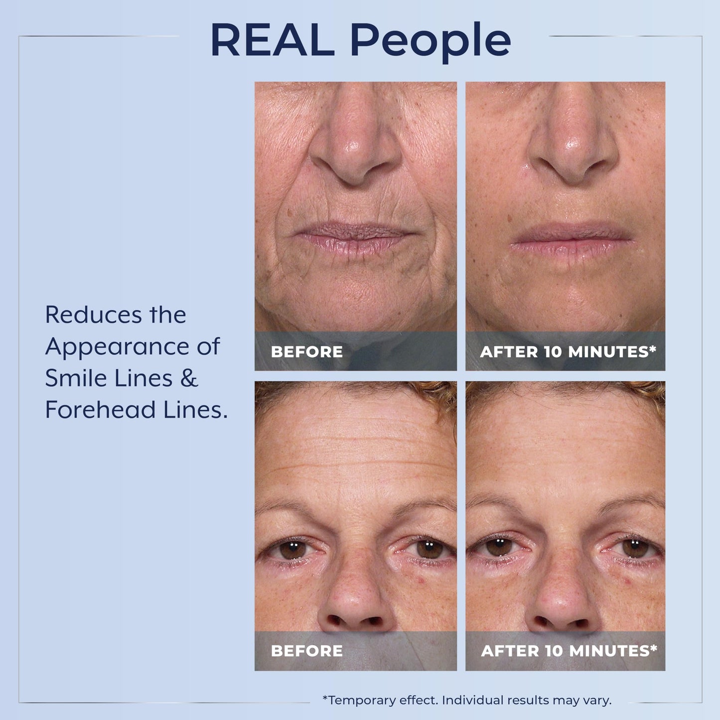 Plexaderm Rapid Reduction Eye Serum - Visibly Reduces Under-Eye Bags, Wrinkles, Dark Circles, Fine Lines & Crow's Feet Instantly, Anti Aging Wrinkle Remover for Face, 30 Single Use Pods