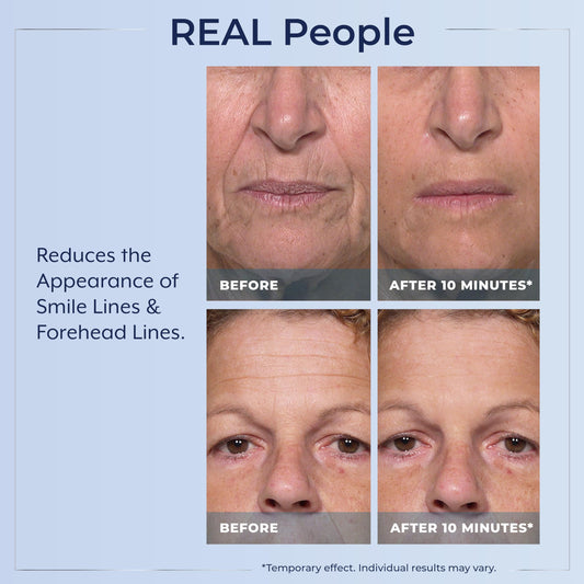 Plexaderm Rapid Reduction Eye Serum - Visibly Reduces Under-Eye Bags, Wrinkles, Dark Circles, Fine Lines & Crow's Feet Instantly, Anti Aging Wrinkle Remover for Face, 30 Single Use Pods