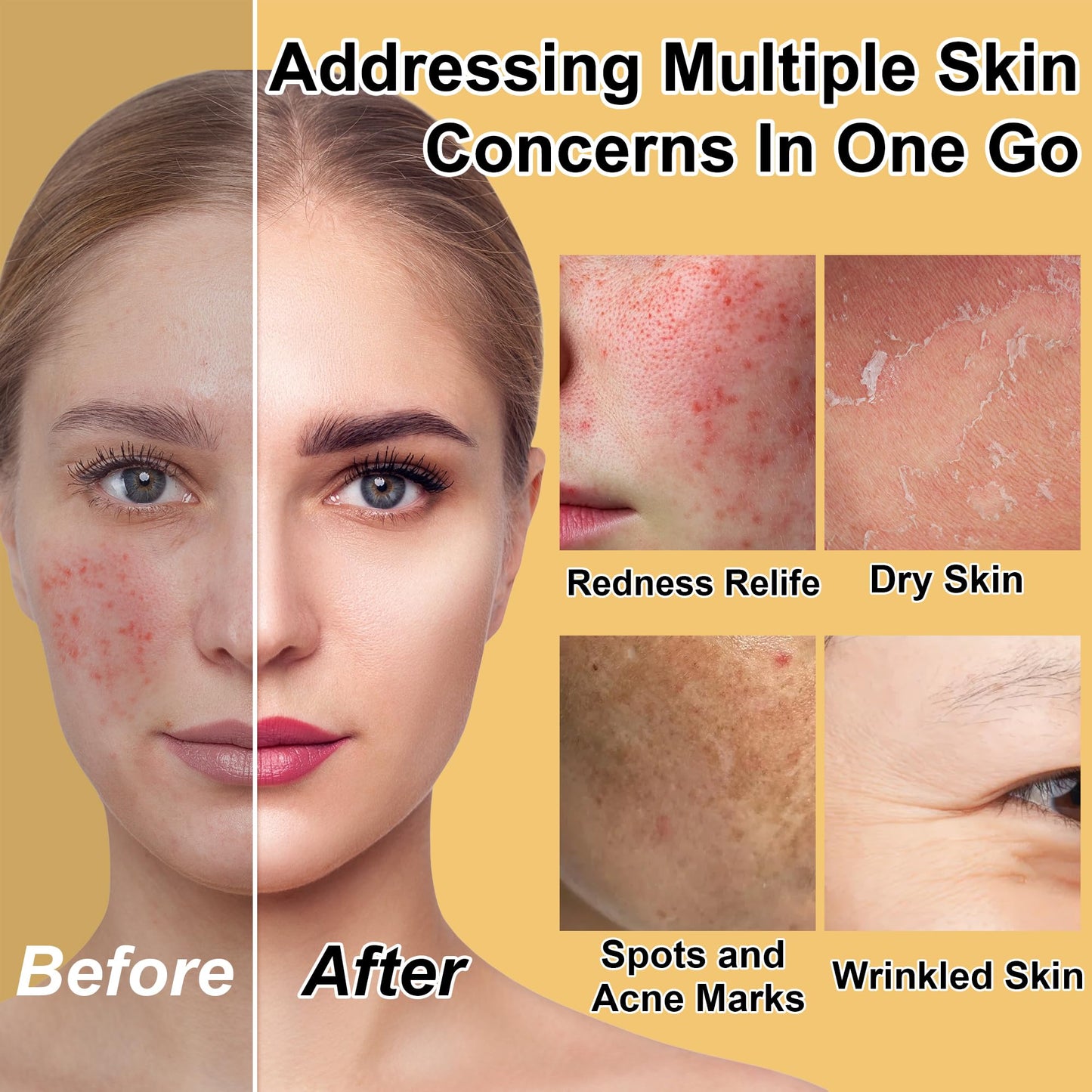 Skin Care Set for Teens Women,Anti-Aging Deeply Hydrates Repairs Skincare Gift Set for All Skin,Facial Skin Care Products Routine Kit Christmas Beauty Gift Set for Women