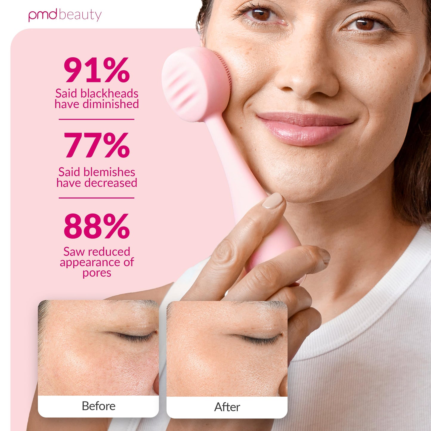 PMD Beauty: Electric Facial Cleansing Brush - Smart Facial Device with Silicone Brush & Anti-Aging Massager, Blush
