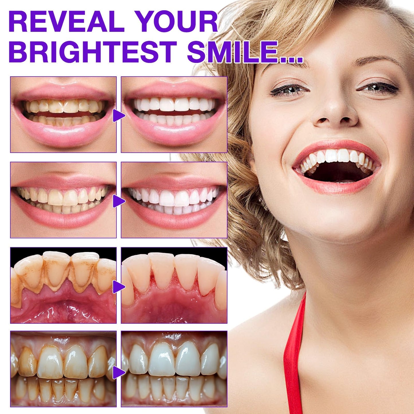 Toothpaste Tablets, Chewable Toothpaste Tablets for Fresh Breath, Natural Whitening Floride-Free and Remineralizing Tablets Tabs, Nano Hydroxyapatite Toothpaste, 150 Tablets