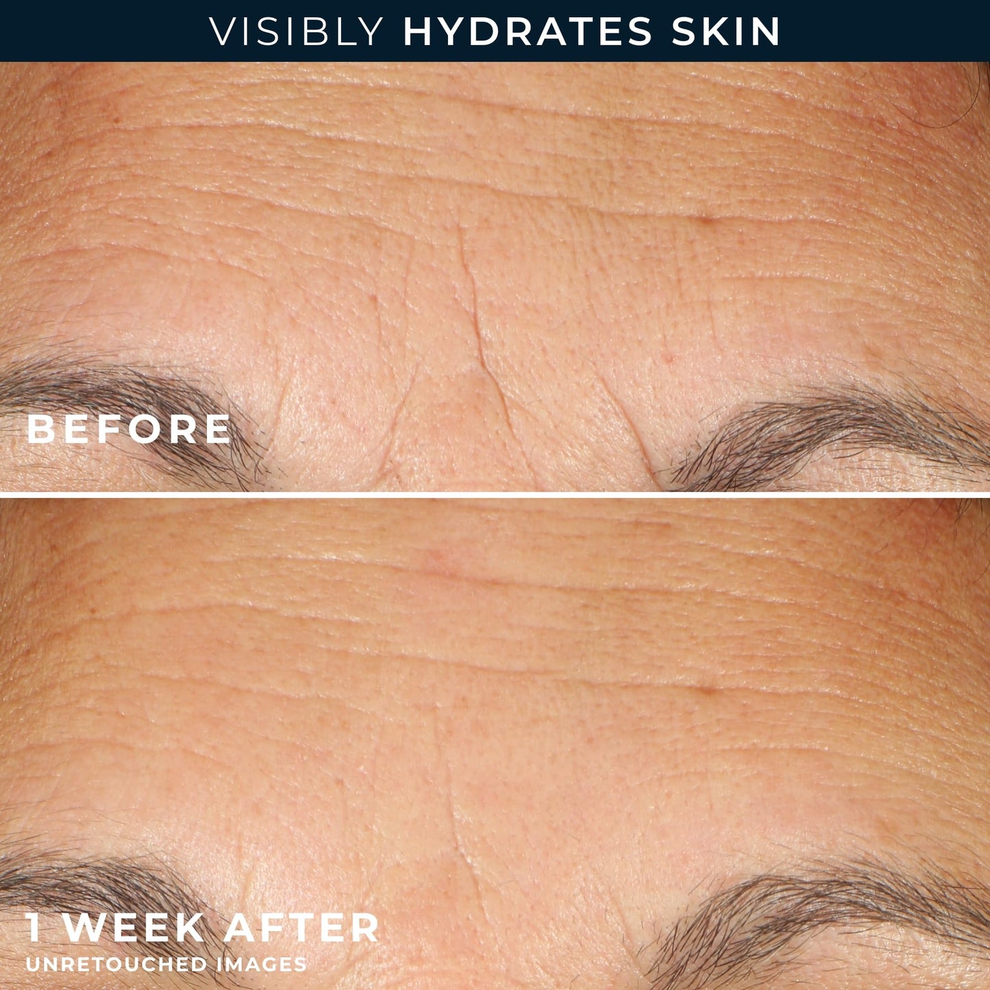 RoC Multi Correxion Hyaluronic Acid Night Serum Capsules (30 CT) for Intense Hydration + RoC Retinol Capsules (7 CT), Anti-Aging Skin Care Wrinkle Treatment for Women and Men