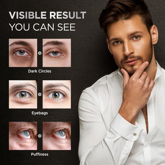 Under Eye Cream for Puffiness and Bags: Caffeine Serum Roller for Dark Circles Treatment - With 5% Caffeine Retinol Hyaluronic Acid Niacinamide Peptides 0.5 fl. oz