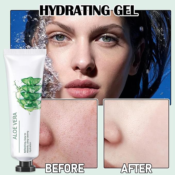 8Pcs Aloe Vera Gel for After Sun Skin Care