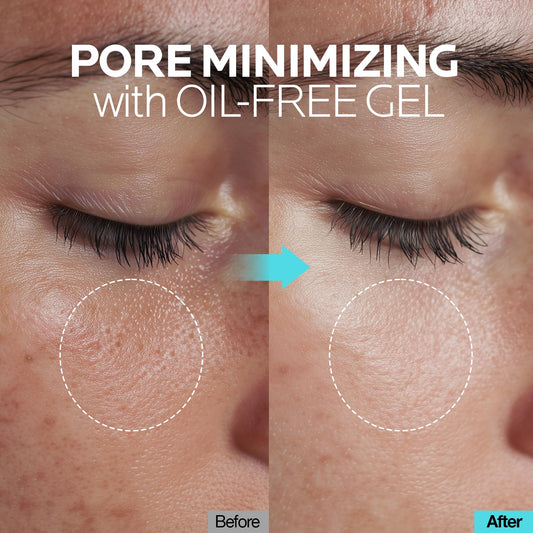 mimmua! Ice Sorbet Soothing Cooling Face Moisturizer | Pore Minimizer for Face Before Makeup | After Sun Care for Sunburn, Heat Rash & Calming Gel Cream After Shower | Korean Skincare | 3.38 Fl Oz