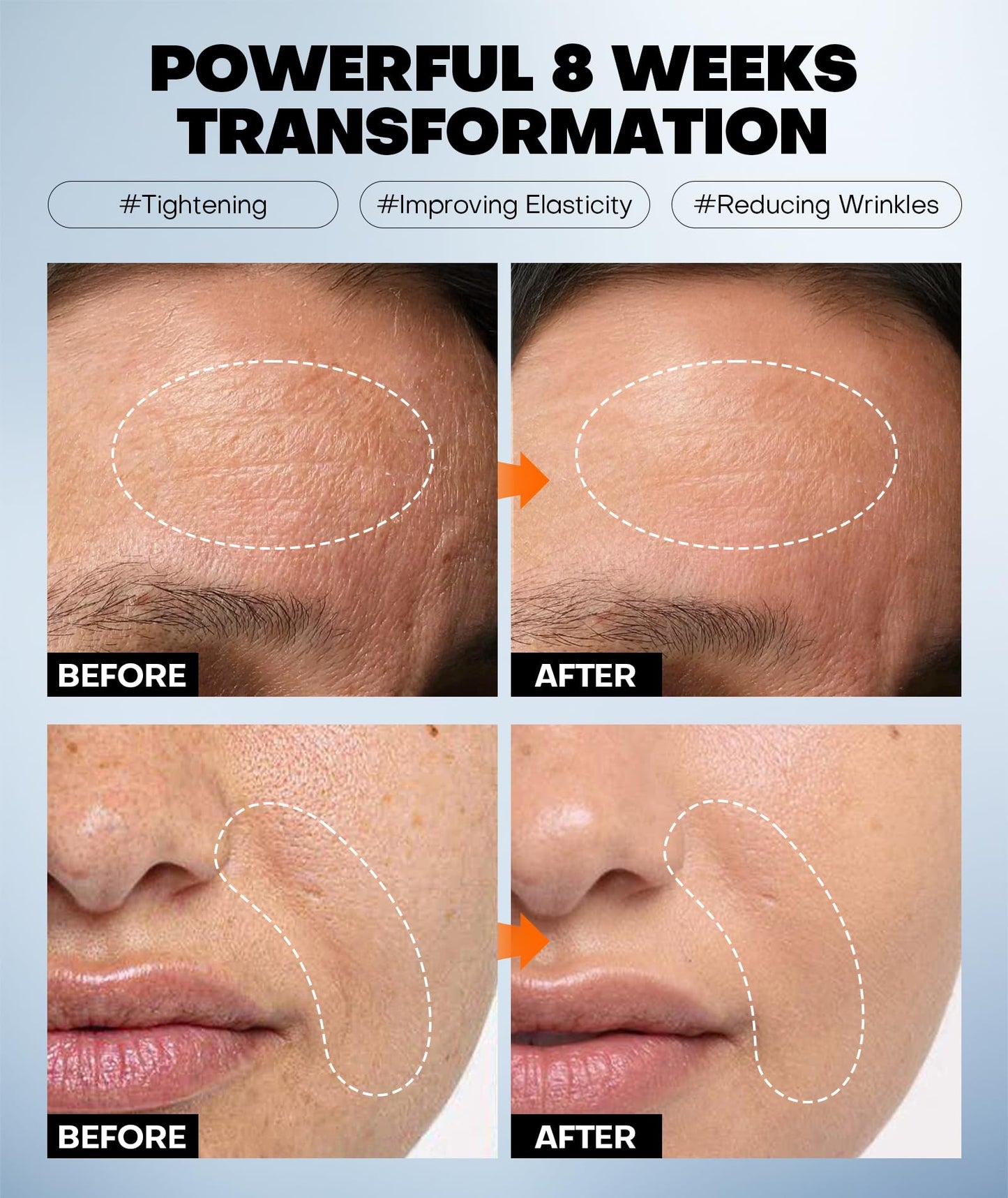 Radiant Glow Collagen Face Mask - Real Deep Overnight Face Masks Skincare with Hyaluronic Acid, Galactomyces Ferment & Vitamin E, Facial Mask for Hydrating, Firming, Plumping & Anti-Aging - 34g x 5ea